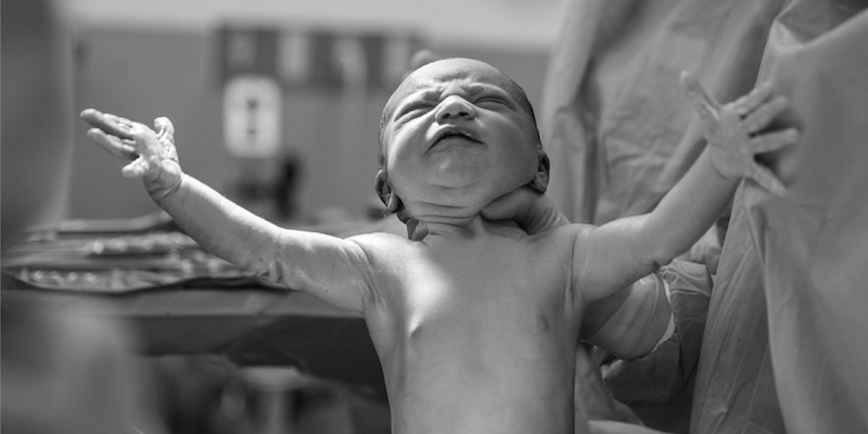 The Benefits of Delayed Clamping for Umbilical Cords