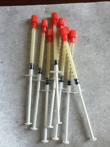 Syringes filled with colostrum for NICU baby